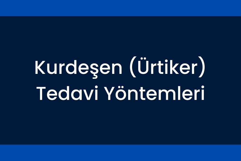 Kurdeşen Ürtiker Tedavi Yöntemleri