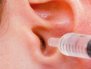 Tedavi edilmezse işitme kaybına kadar götürüyor! Kulakta sıvı birikmesi belirtileri nelerdir?