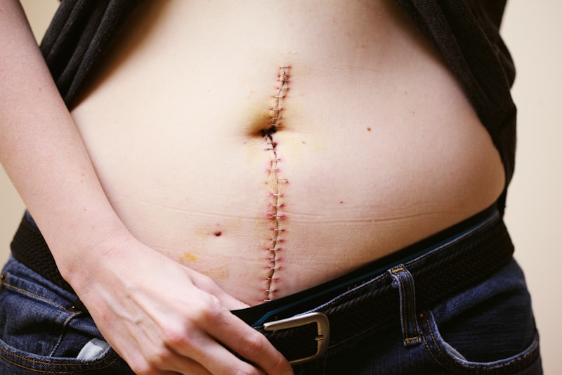 Gastroenteroloji nedir? Sindirim Sistemi Hakkındaki Şok Gerçekler Gastroenteroloji nedir? Sindirim Sistemi Hakkındaki Şok Gerçekler