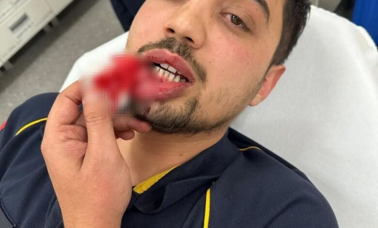 bursada ambulans surucusune saldiri kalp krizi geciren hastayi tasiyan surucu darp edildi YsftaNSl.jpg