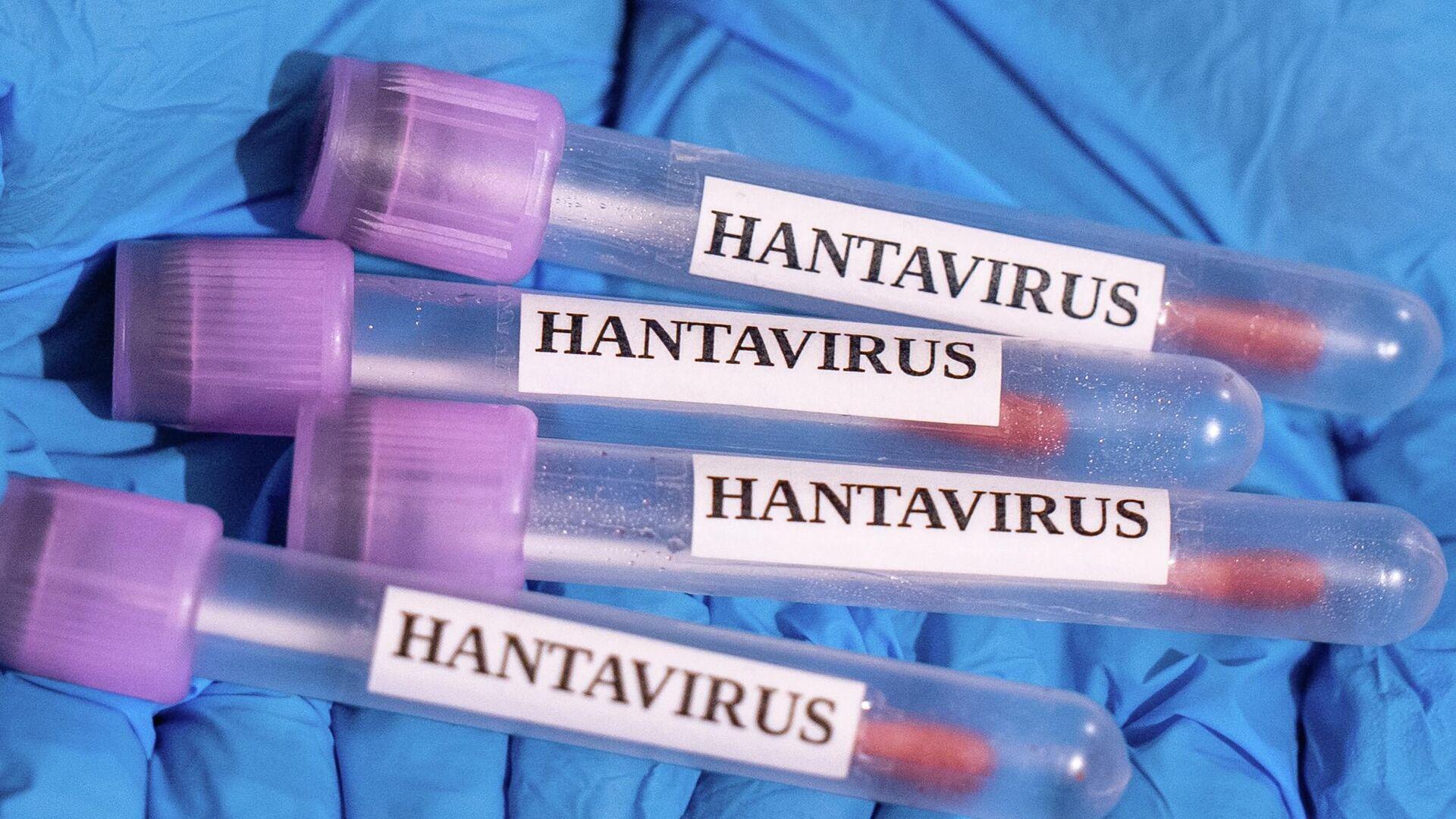 Hantavirüs tehlikesine dikkat! Enfekte kişilerde ağır seyirler görülebilir. Bilgi için