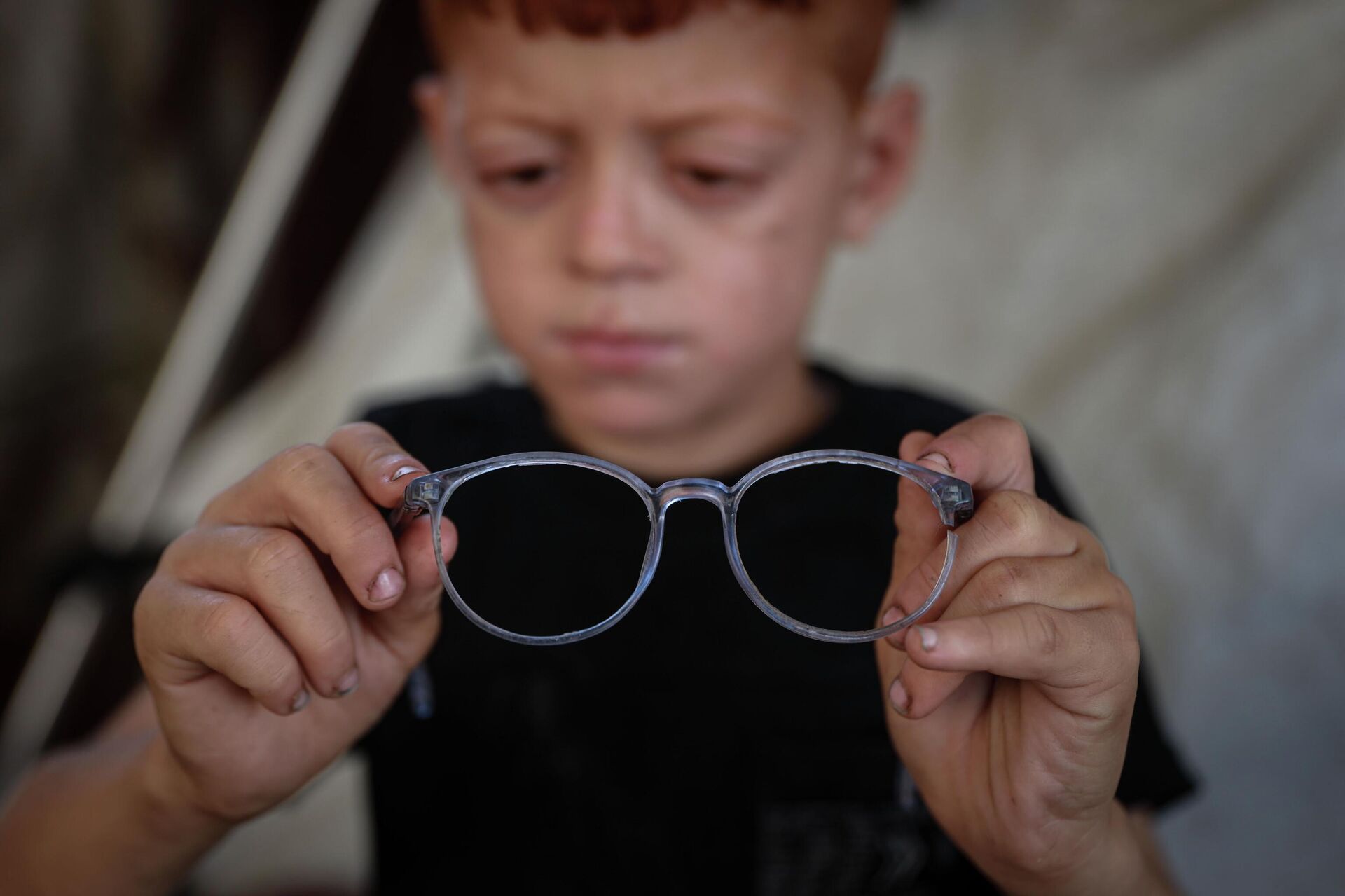 Gazze'de Çocuk Eyüp'ün Görme Sorunu Gündemi Sarstı
