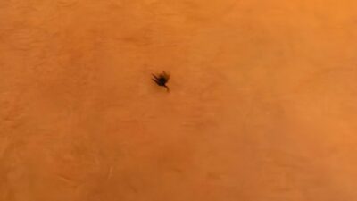 İnegöl'de çocukta göğsüne yapışan keneyi güvenli bir şekilde çıkarma ve